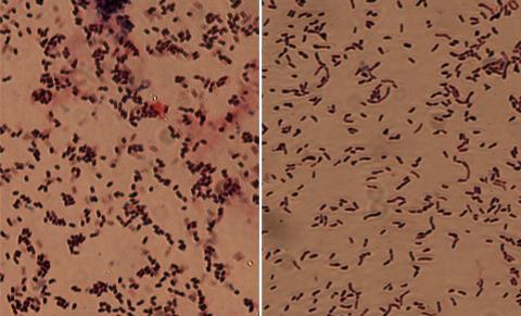 引起干豆青枯病和玉米青枯病的细菌的比较。干豆萎蔫病菌中的短杆菌（左）比戈斯萎蔫病菌克拉维杆菌（右）短而肥。